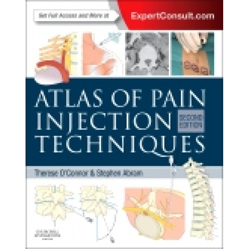 Atlas of Pain Injection Techniques, 2nd Edition